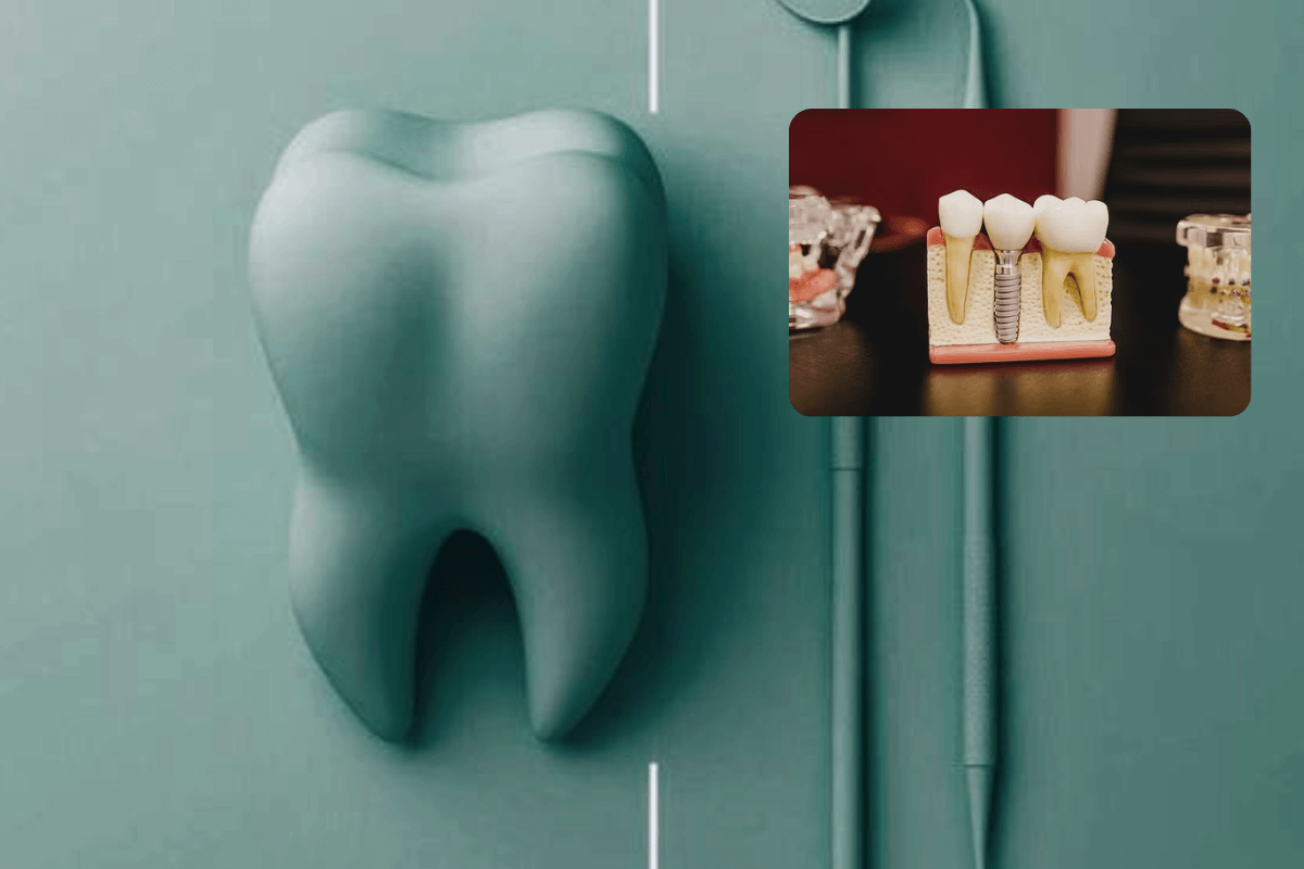 Исследователи разработали стоматологический каркас со стронцием