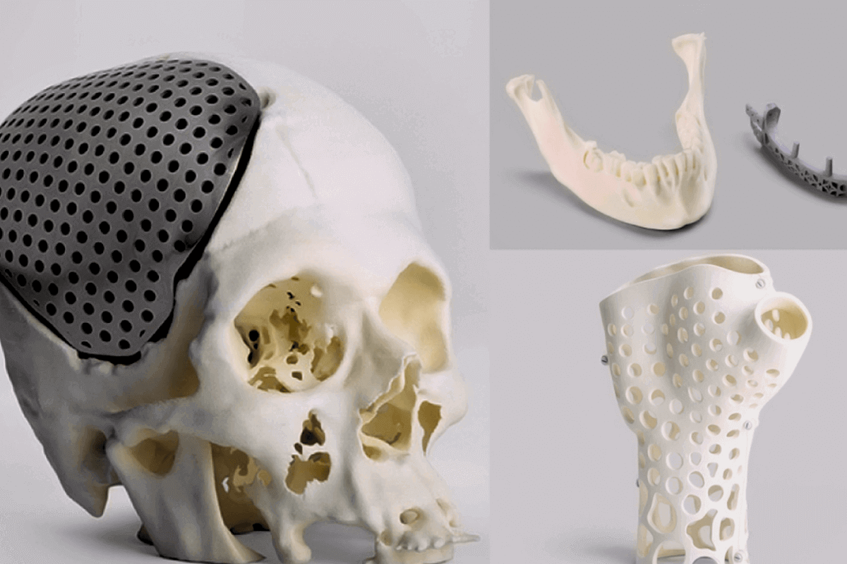 Лучшие технологии, на которые стоит обратить внимание в 2022 и 2023 году: 3D-печать костных имплантатов
