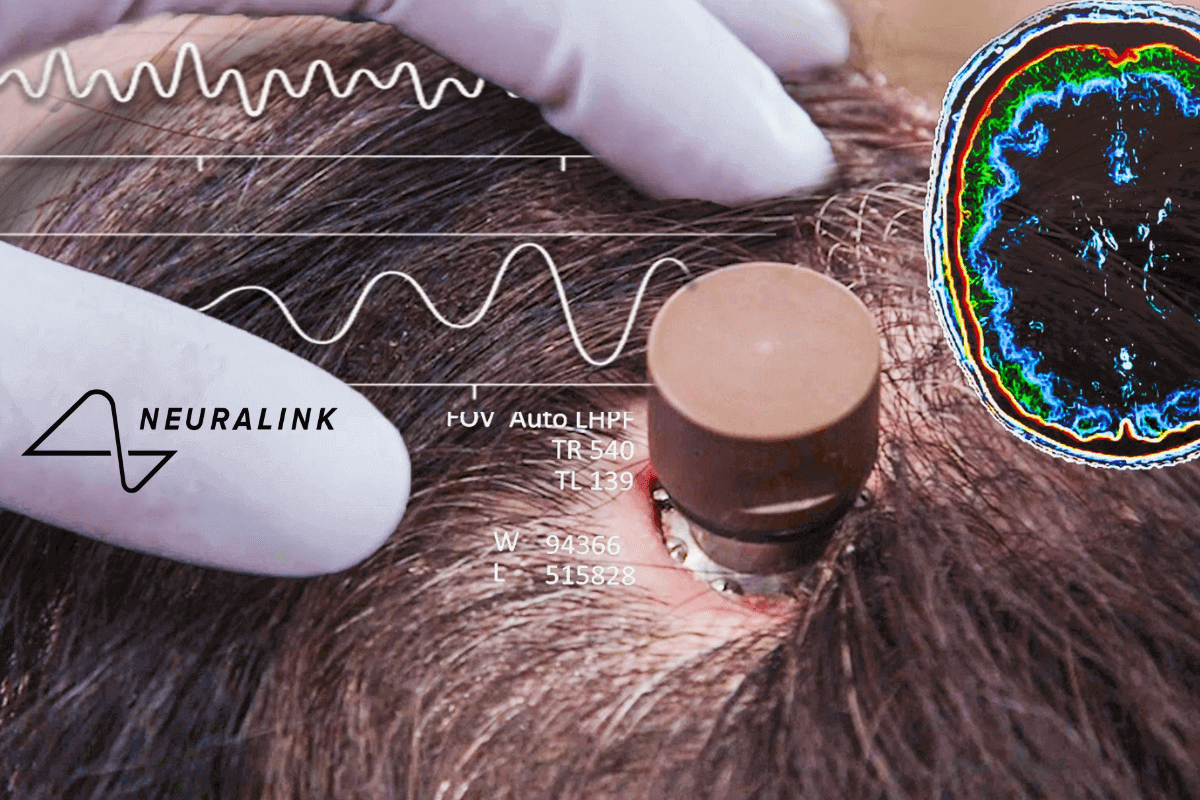 Компания Илона Маска вживила первому человеку чип в мозг